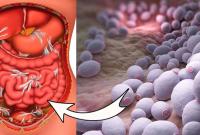 Симптомы разрастания дрожжей в организме